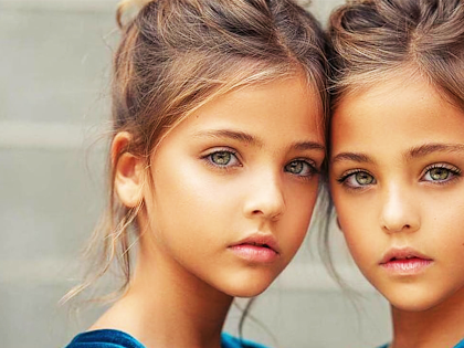 Twins Were Named "Most Beautiful in the World," Wait Till You See Them Now