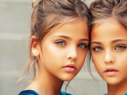 Twins Were Named "Most Beautiful in the World," Wait Till You See Them Now