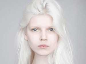 These 50 Photos of Unique People Show That Genetics is Hard to Forget