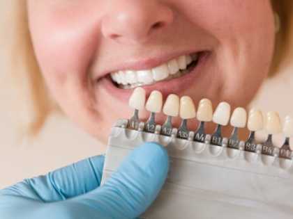 What Full Mouth Dental Implants Should Cost In Brandon