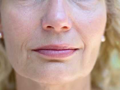 Doctors Stunned: 72 Year Old Grandma Clears Her Wrinkles With This Method