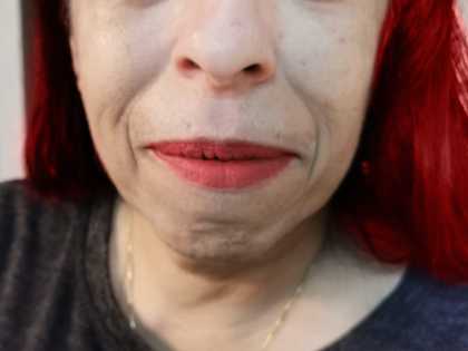 Doctors Stunned: 72 Year Old Grandma Clears Her Wrinkles With This Method