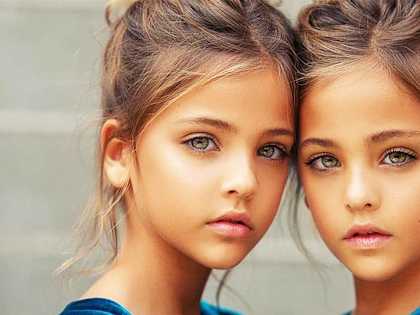 Twins Were Named "Most Beautiful in the World," Wait Till You See Them Now 