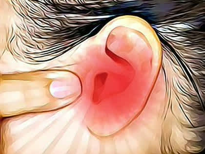 If You Have Ringing Ears Do This Immediately (Ends Tinnitus)