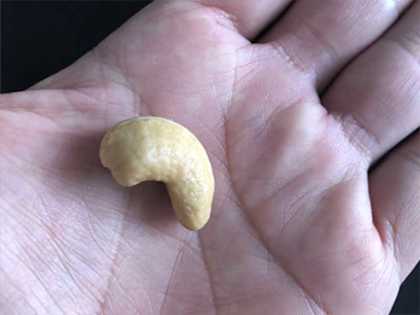 Suffering from Diabetes? Do This Immediately (Watch)