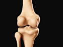 Newly-discovered Root Factor in Age-related Joint Decay