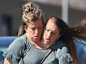 Twins Who Were Once Conjoined Now Living Apart - Take a Look