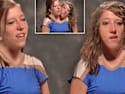 Remember Hensel Twins? Take a Deep Breath Before You See Her Now