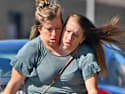 Incredible Story: Twins Separated After Being Conjoined!