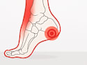 Neuropathy is Linked to This Household Item (Stop Using It)