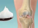 Joint Pain? This 'Oil Trick' Works Like Crazy