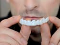 The New Dental Implants Everyone is Talking About